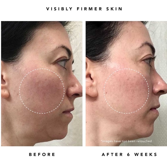 Pick8/$50 Herbivore MoonFruit 1% Bakuchiol+Peptides Retinol Alt. Serum🆕delsamp - Picture 5 of 9